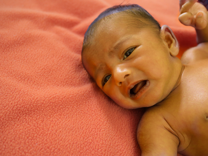 Young baby lying on their back on a blanket with jaundice yellow coloured skin, looking in pain.